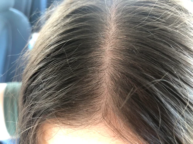 example of your hair photo